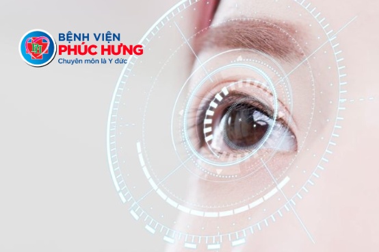 Mộng thịt mắt có nguy hiểm không? Khi nào cần can thiệp sớm?
