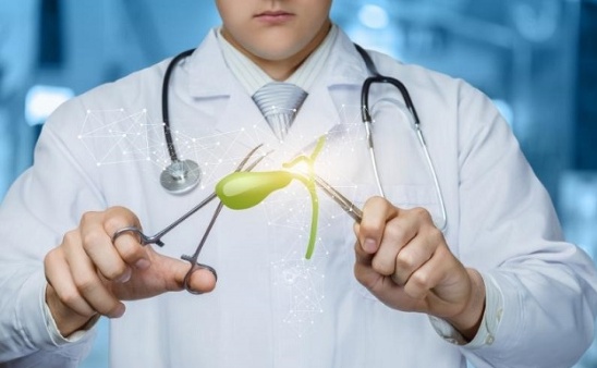 Polyp túi mật khi nào cần phẫu thuật?