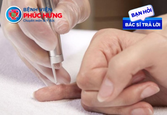 Phòng khám Da liễu Phúc Hưng có điều trị mụn cóc bằng Laser không?