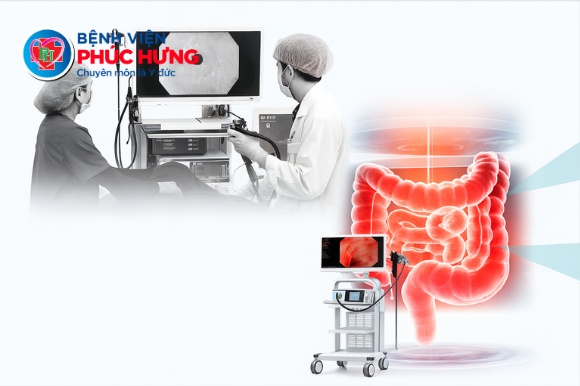 Phát hiện u nang bạch mạch đại tràng hiếm gặp nhờ nội soi kỹ thuật cao tại Bệnh viện Phúc Hưng