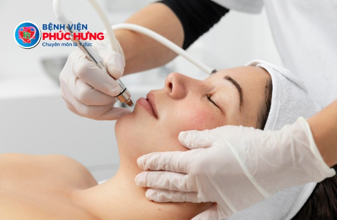 Điều trị mụn bao lâu thì cải thiện?