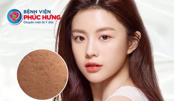 Lăn kim tái tạo da 