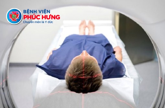 Chụp CT não - phát hiện sớm tổn thương não nguy hiểm sau chấn thương