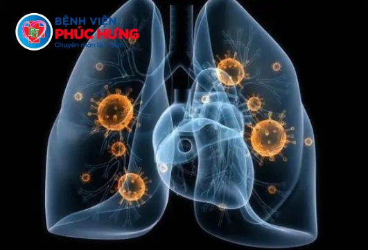 Thời điểm giao mùa tăng nguy cơ bệnh lý đường hô hấp, cúm