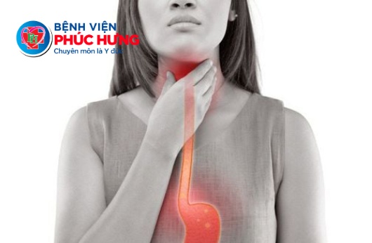 Achalasia - khi thực quản 