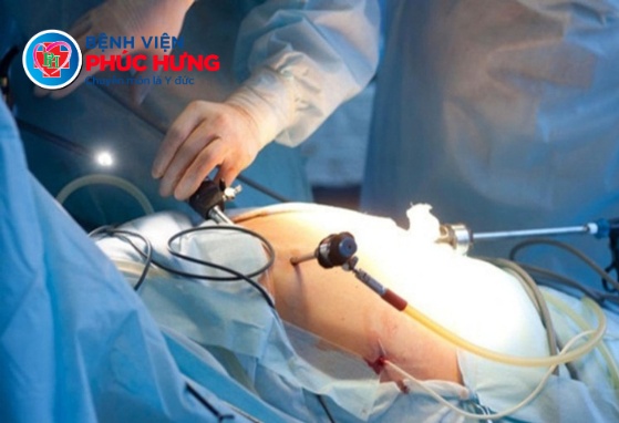 Khai xuân tại Phúc Hưng: Những cuộc 