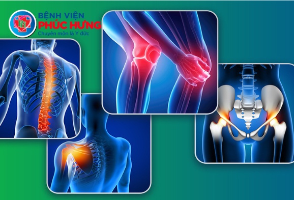 Khoa Ngoại chấn thương - Bệnh viện Phúc Hưng: Địa chỉ tin cậy trong điều trị các bệnh lý xương khớp