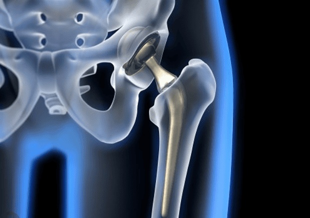 Phẫu thuật thành công nhiều ca chấn thương phức tạp tại Khoa Ngoại Chấn Thương