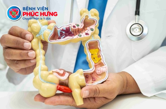 Nội soi đại tràng - lá chắn bảo vệ sức khỏe sau tuổi 40