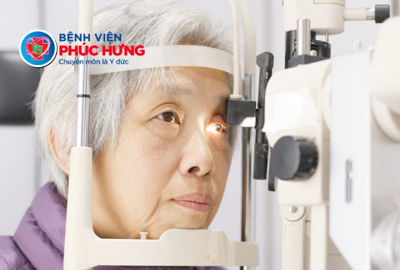 Đục thủy tinh thể dễ mắc phải với người có bệnh nền