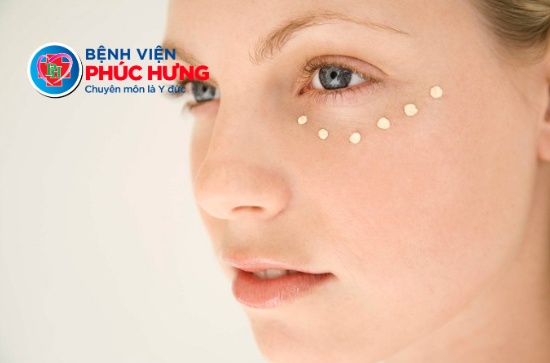 Liệu trình điều trị thâm mắt chuyên sâu tại Phòng Khám Da Liễu - Bệnh viện Phúc Hưng