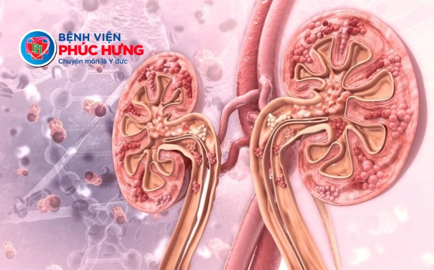 Suy thận và Gout: Hai bệnh lý liên quan chặt chẽ, càng để lâu càng nặng