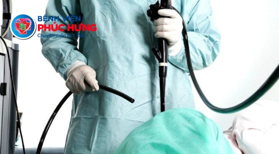 Bao lâu nên Nội soi Hệ tiêu hóa một lần để đề phòng ung thư?