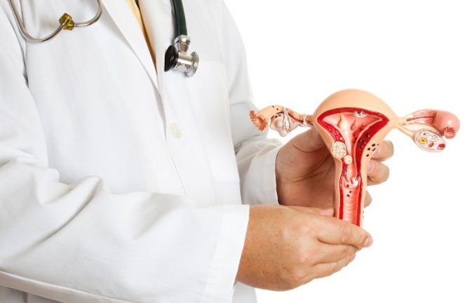 Phẫu thuật thành công một trường hợp u xơ tử cung kích thước lớn có trọng lượng 2500gr.