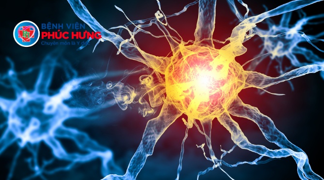 U bao dây thần kinh số 8 – Dấu hiệu nhận biết sớm để tránh biến chứng nguy hiểm