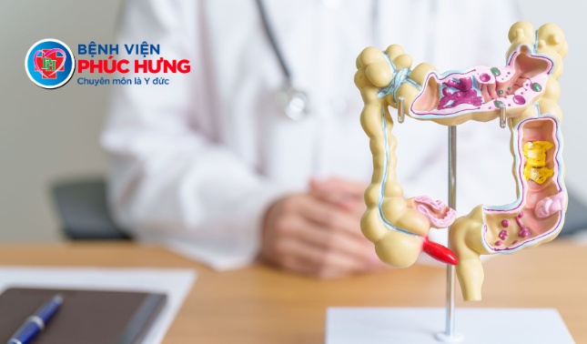 Đừng chủ quan với đau hậu môn - đau bụng âm ỉ