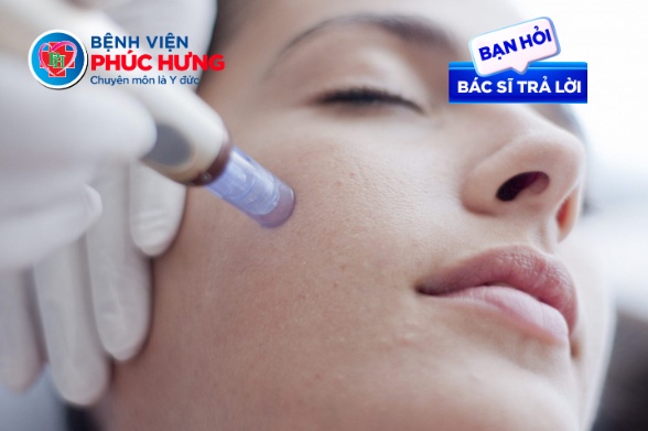 Lăn kim có đau không? Có cần nghỉ dưỡng không?