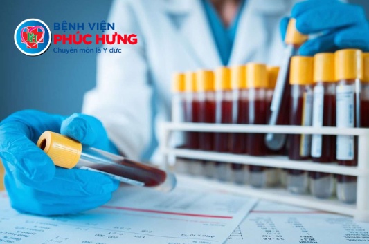 Sau Tết có nên thực hiện xét nghiệm tổng quát