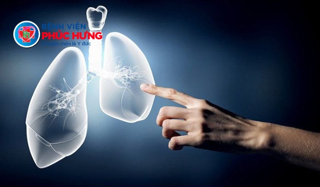 Đái tháo đường và Lao phổi: Mối liên quan nguy hiểm không nên chủ quan