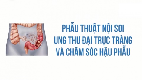 VIDEO TỌA ĐÀM VỀ PHẪU THUẬT NỘI SOI UNG THƯ ĐẠI TRỰC TRÀNG VÀ CHĂM SÓC HẬU PHẪU