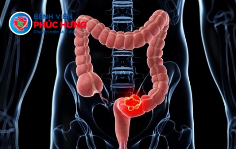 Những thắc mắc thường gặp khi muốn nội soi tiêu hóa