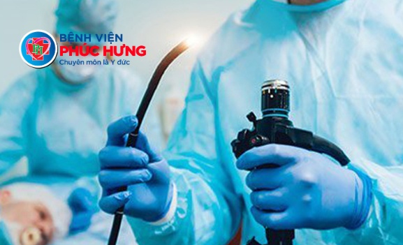 Nội soi tiêu hóa không đau - Chủ động phát hiện sớm ung thư đường tiêu hóa