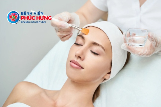 Peel da mụn - Giải pháp cho làn da sạch khuyết điểm