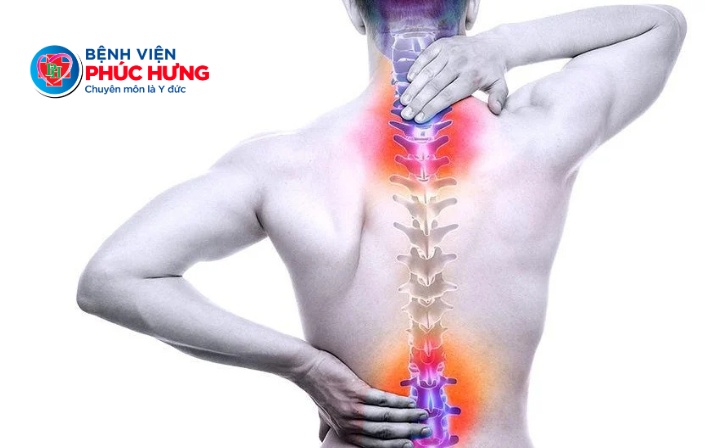 Bệnh lý cột sống đang trẻ hóa - Đừng để đau lưng trở thành 