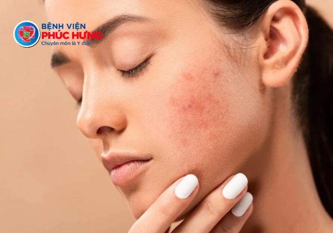 Vì sao ăn ngọt nhiều khiến da kém sắc?