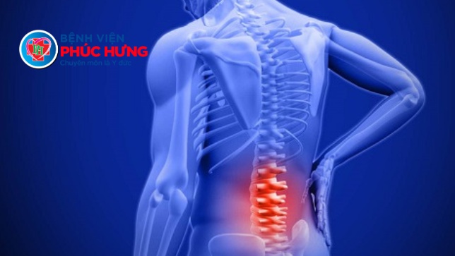 Phẫu thuật thành công ca hẹp ống sống thắt lưng cho bệnh nhân người Mỹ gốc Việt
