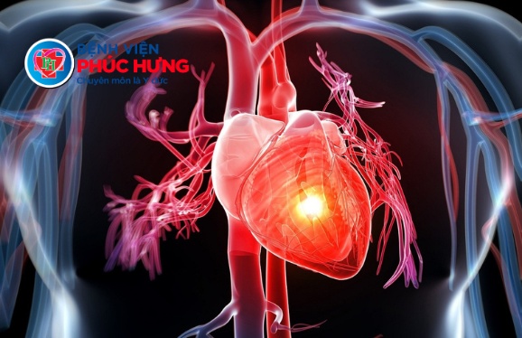 Đau ngực - Có phải là dấu hiệu của bệnh tim? Đừng chủ quan