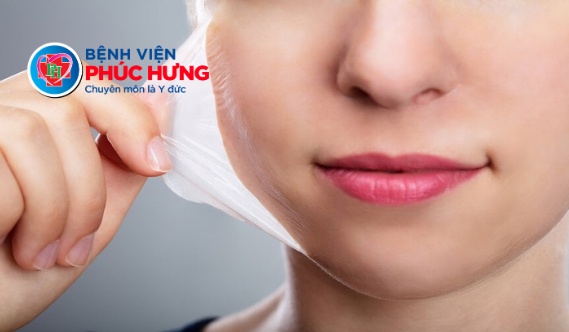 Peel da - Giải pháp đột phá cho sẹo mụn, sẹo rỗ và rạn da