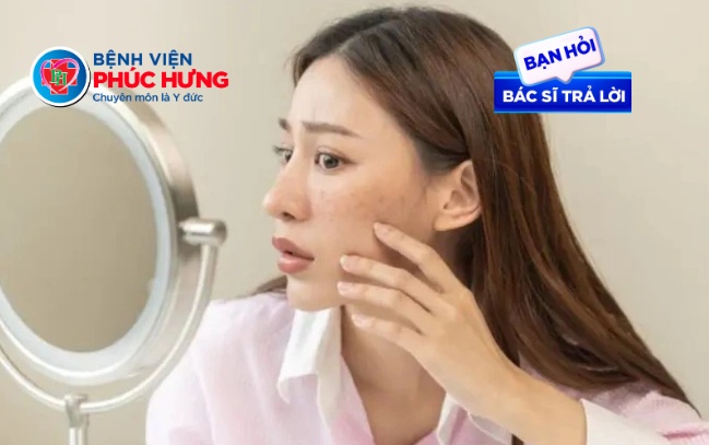 Sẹo mụn lâu năm có điều trị được không?