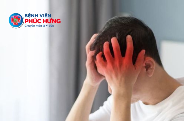 Đau đầu dữ dội sau cuộc vui? Cẩn trọng nguy cơ tụ máu dưới màng cứng
